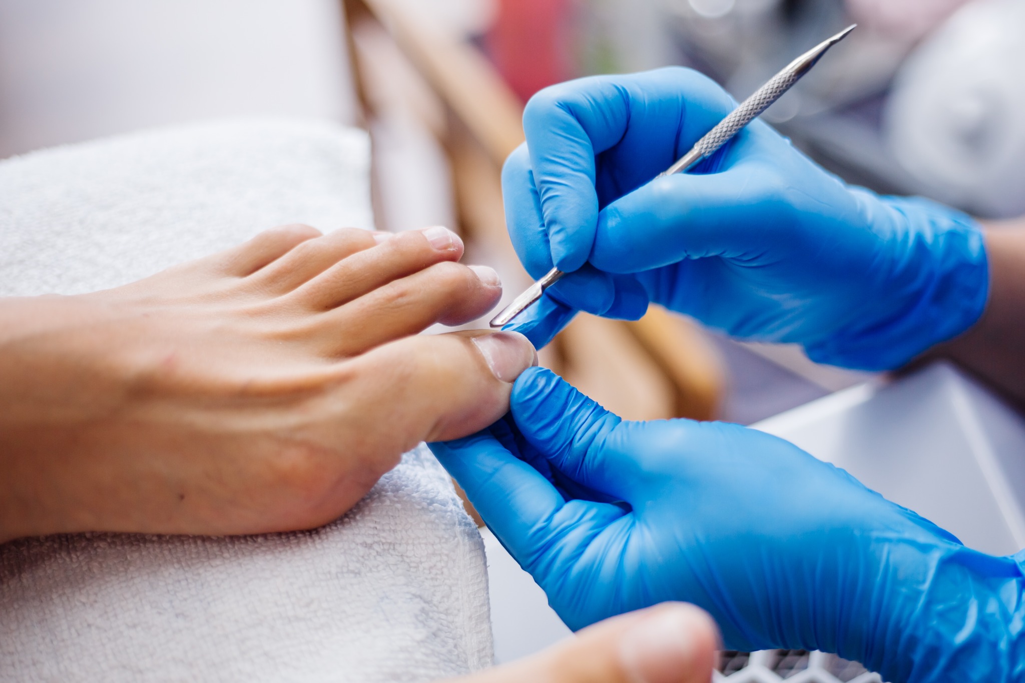 Toenail and foot care