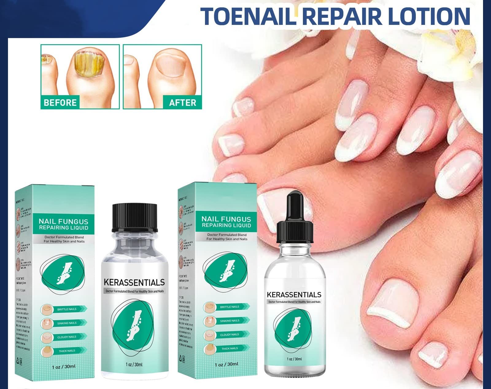 Fungal Nail Risk Factors